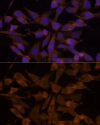 Anti-UGT2B7 antibody used in Immunocytochemistry/ Immunofluorescence (ICC/IF). GTX32950