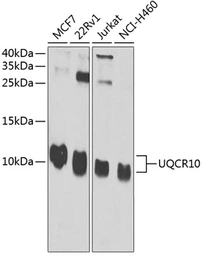 Anti-UQCR10 antibody used in Western Blot (WB). GTX32954