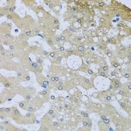 Anti-UQCR10 antibody used in IHC (Paraffin sections) (IHC-P). GTX32954