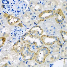 Anti-UQCR10 antibody used in IHC (Paraffin sections) (IHC-P). GTX32954