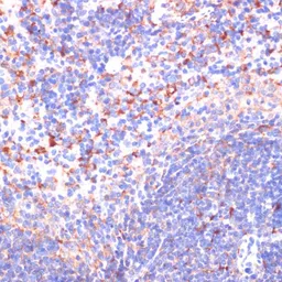 Anti-Von Hippel Lindau antibody used in IHC (Paraffin sections) (IHC-P). GTX32968