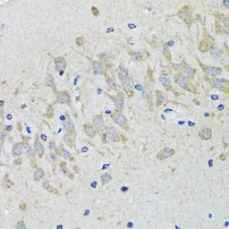 Anti-5-HT2B receptor antibody used in IHC (Paraffin sections) (IHC-P). GTX32984