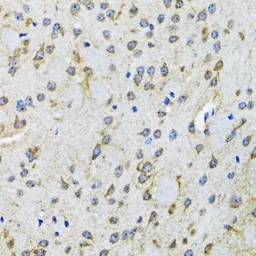 Anti-5-HT2B receptor antibody used in IHC (Paraffin sections) (IHC-P). GTX32984