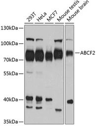 Anti-ABCF2 antibody used in Western Blot (WB). GTX32985