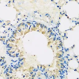Anti-ABCF2 antibody used in IHC (Paraffin sections) (IHC-P). GTX32985