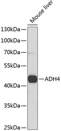 Anti-ADH4 antibody used in Western Blot (WB). GTX32994