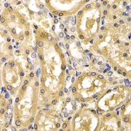 Anti-ADH4 antibody used in IHC (Paraffin sections) (IHC-P). GTX32994