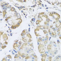 Anti-AMPK gamma 1 antibody used in IHC (Paraffin sections) (IHC-P). GTX33006