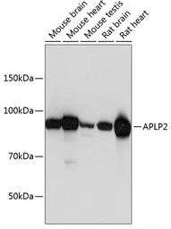 Anti-APLP2 antibody used in Western Blot (WB). GTX33014