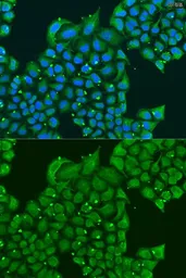 Anti-ATPIF1 antibody used in Immunocytochemistry/ Immunofluorescence (ICC/IF). GTX33029