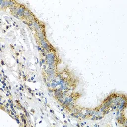 Anti-ATPIF1 antibody used in IHC (Paraffin sections) (IHC-P). GTX33029