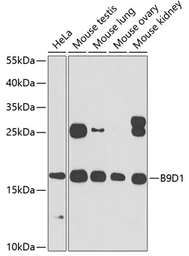 Anti-B9D1 antibody used in Western Blot (WB). GTX33030