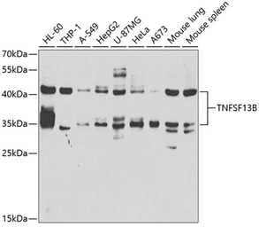 Anti-BAFF antibody used in Western Blot (WB). GTX33032