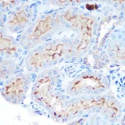 Anti-BAFF antibody used in IHC (Paraffin sections) (IHC-P). GTX33032