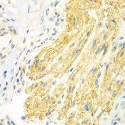 Anti-Brk antibody used in IHC (Paraffin sections) (IHC-P). GTX33043