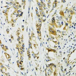 Anti-Cardiac Troponin C antibody used in IHC (Paraffin sections) (IHC-P). GTX33061