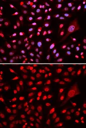 Anti-CBFb antibody used in Immunocytochemistry/ Immunofluorescence (ICC/IF). GTX33066