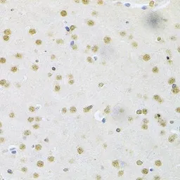 Anti-CBFb antibody used in IHC (Paraffin sections) (IHC-P). GTX33066