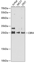 Anti-CBR4 antibody used in Western Blot (WB). GTX33068