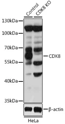 Anti-CDK8 antibody used in Western Blot (WB). GTX33086