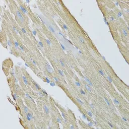 Anti-CKMT2 antibody used in IHC (Paraffin sections) (IHC-P). GTX33098