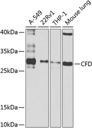 Anti-Complement Factor D antibody used in Western Blot (WB). GTX33107