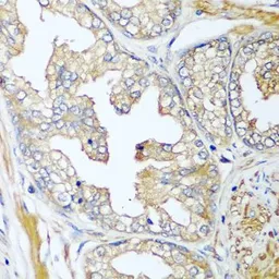 Anti-Complement Factor D antibody used in IHC (Paraffin sections) (IHC-P). GTX33107