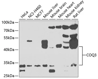 Anti-COQ3 antibody used in Western Blot (WB). GTX33110