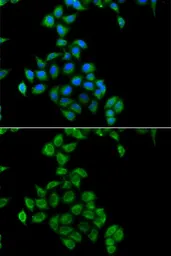 Anti-COQ3 antibody used in Immunocytochemistry/ Immunofluorescence (ICC/IF). GTX33110