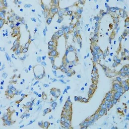 Anti-Cytokeratin 15 antibody used in IHC (Paraffin sections) (IHC-P). GTX33139
