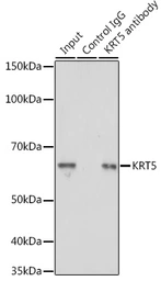 Anti-Cytokeratin 5 antibody used in Immunoprecipitation (IP). GTX33140