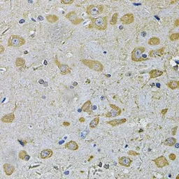 Anti-DAAM2 antibody used in IHC (Paraffin sections) (IHC-P). GTX33141