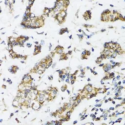 Anti-DHRS2 antibody used in IHC (Paraffin sections) (IHC-P). GTX33152
