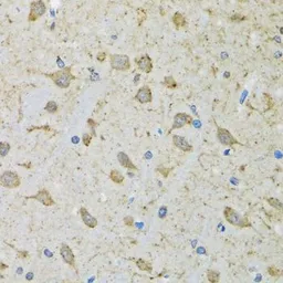 Anti-DHRS2 antibody used in IHC (Paraffin sections) (IHC-P). GTX33152