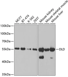 Anti-DLD antibody used in Western Blot (WB). GTX33155