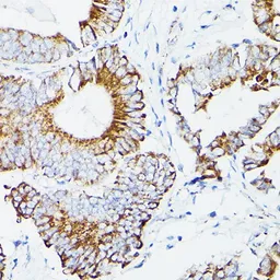 Anti-DLD antibody used in IHC (Paraffin sections) (IHC-P). GTX33155