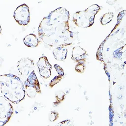 Anti-DLD antibody used in IHC (Paraffin sections) (IHC-P). GTX33155