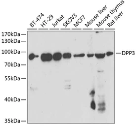 Anti-DPP3 antibody used in Western Blot (WB). GTX33164