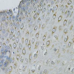 Anti-eIF4B antibody used in IHC (Paraffin sections) (IHC-P). GTX33175