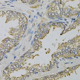 Anti-eIF4B antibody used in IHC (Paraffin sections) (IHC-P). GTX33175
