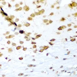 Anti-HuC antibody used in IHC (Paraffin sections) (IHC-P). GTX33177