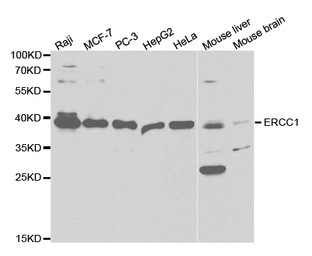 Anti-ERCC1 antibody used in Western Blot (WB). GTX33185