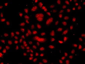 Anti-FBXW11 antibody used in Immunocytochemistry/ Immunofluorescence (ICC/IF). GTX33193