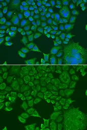 Anti-FXR1 antibody used in Immunocytochemistry/ Immunofluorescence (ICC/IF). GTX33206