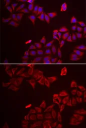 Anti-Galectin 8 antibody used in Immunocytochemistry/ Immunofluorescence (ICC/IF). GTX33214