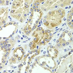 Anti-HMGCL antibody used in IHC (Paraffin sections) (IHC-P). GTX33242