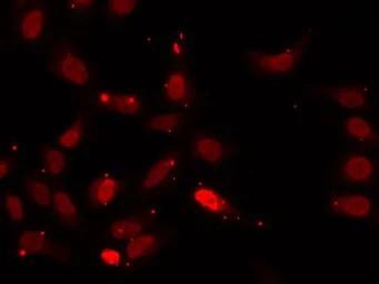 Anti-hnRNP F antibody used in Immunocytochemistry/ Immunofluorescence (ICC/IF). GTX33243