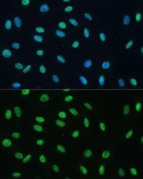 Anti-hnRNP M antibody used in Immunocytochemistry/ Immunofluorescence (ICC/IF). GTX33245
