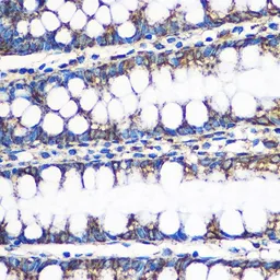 Anti-ERAB antibody used in IHC (Paraffin sections) (IHC-P). GTX33249