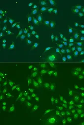Anti-IFIT3 antibody used in Immunocytochemistry/ Immunofluorescence (ICC/IF). GTX33255